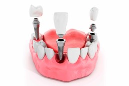 instituto-braga-de-odontologia-e-pesquisa-instituto-ibop-dentistas-cursos-implante-2019
